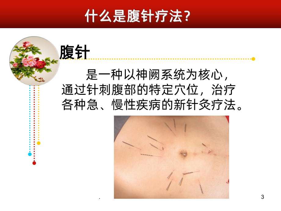 调气扶阳腹针PPT课件.ppt_第3页