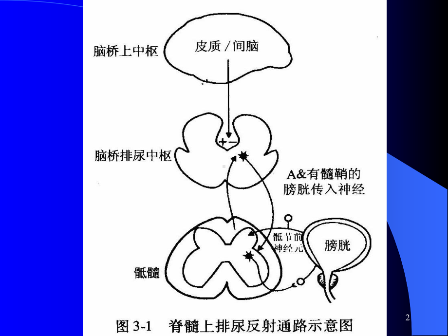 排尿障碍PPT课件.ppt_第2页