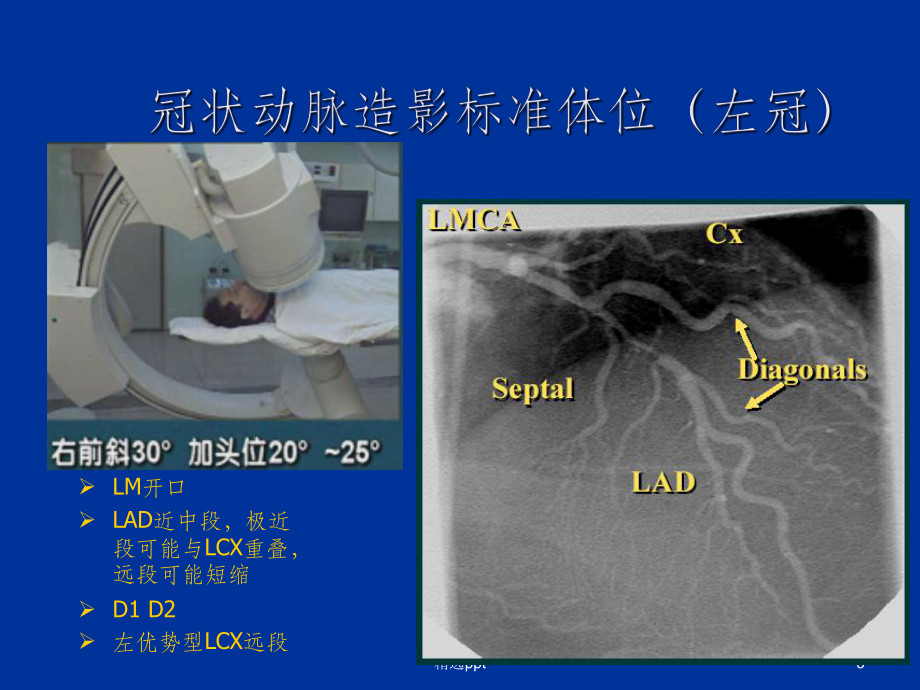 冠脉造影投照体位1PPT课件.ppt_第3页