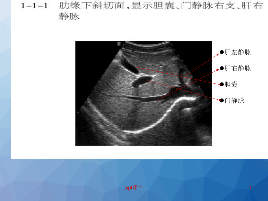 肝胆超声解剖-ppt课件.ppt_第1页