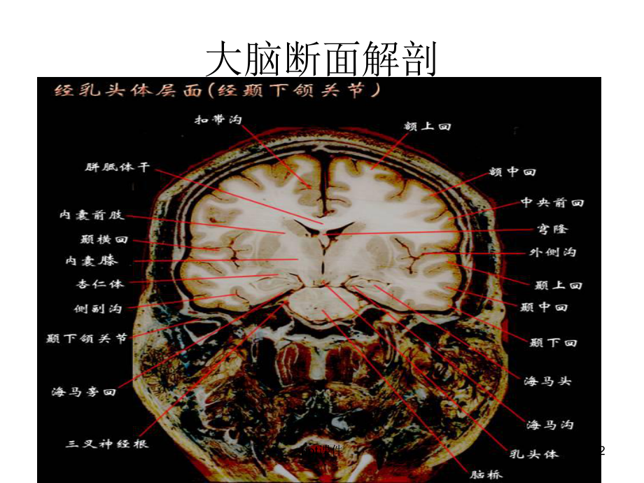 大脑结构图图例-ppt课件.ppt_第2页