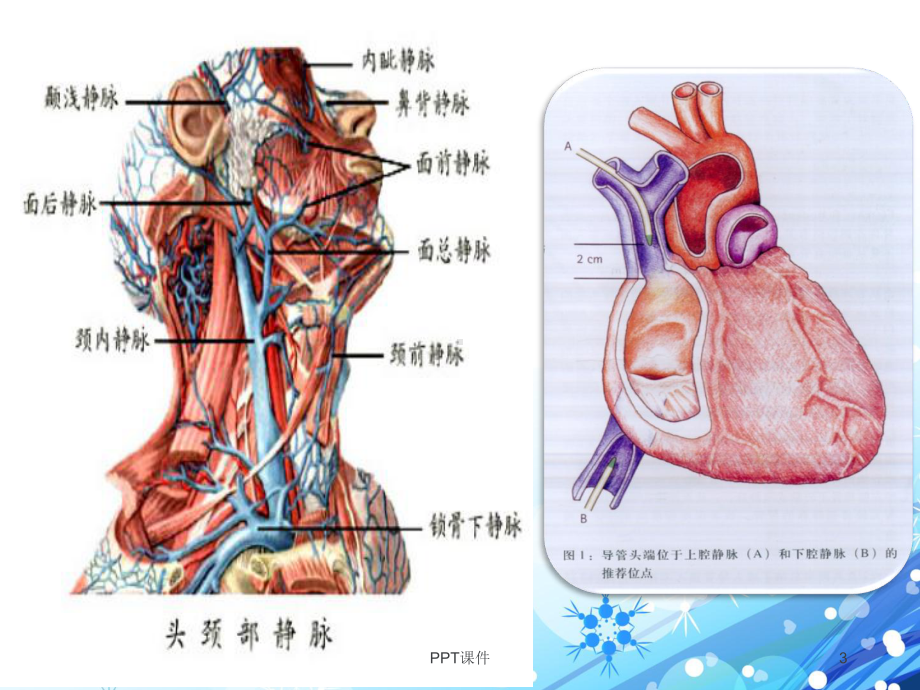 CVC的维护-ppt课件.ppt_第3页