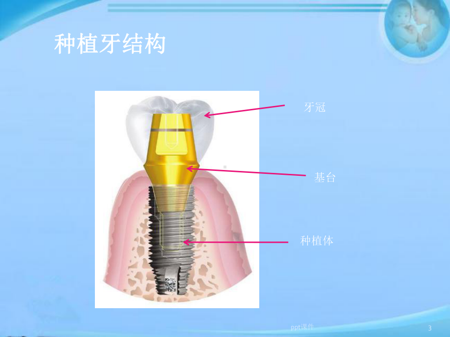 口腔专业知识培训-ppt课件.pptx_第3页