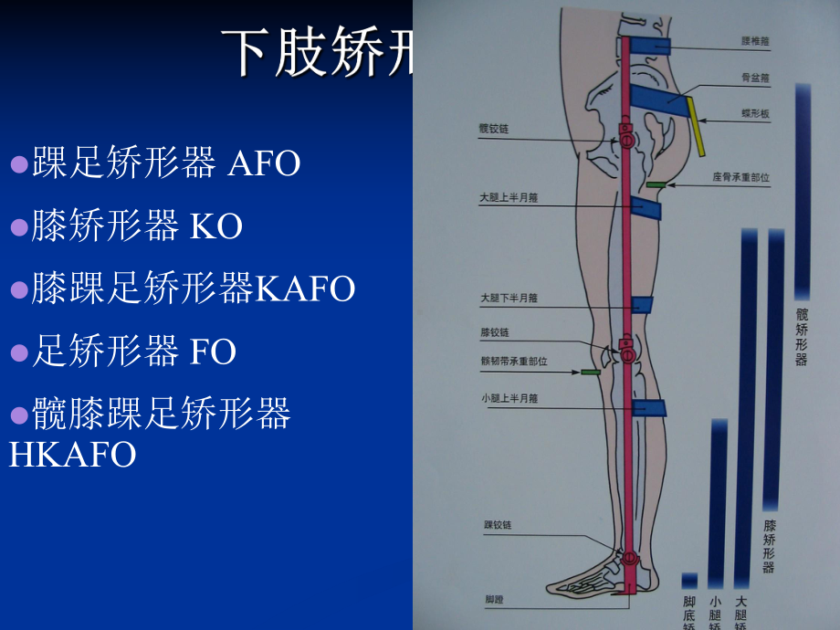 下肢矫形器-ppt课件.ppt_第2页