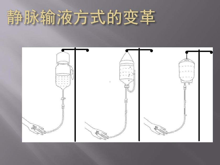 静脉输液安全PPT课件.ppt_第3页