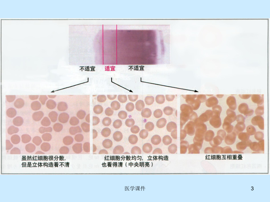 外周血细胞形态的观察-ppt课件.ppt_第3页