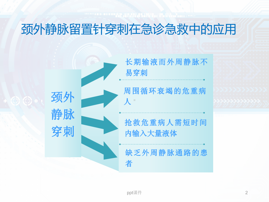 颈外静脉留置针穿刺技巧-ppt课件.ppt_第2页