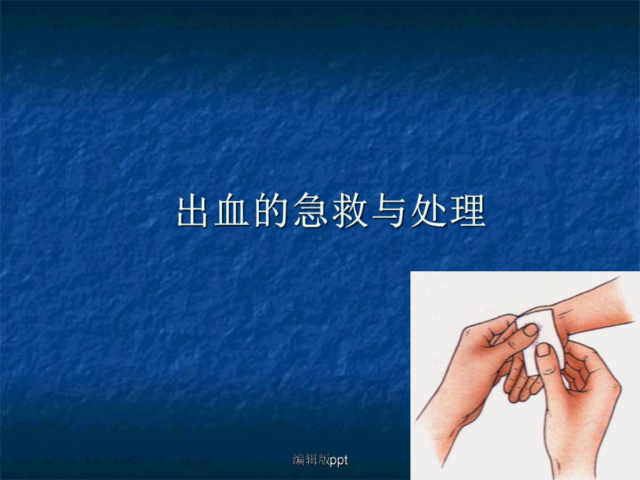 出血的急救与处理PPT课件.ppt_第2页