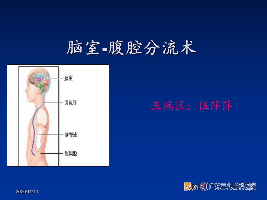 脑室腹腔分流术-ppt课件.ppt_第1页