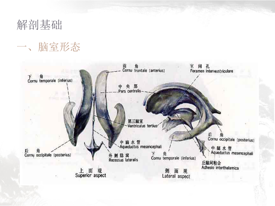 侧脑室穿刺术及脑脊液引流-ppt课件.ppt_第2页