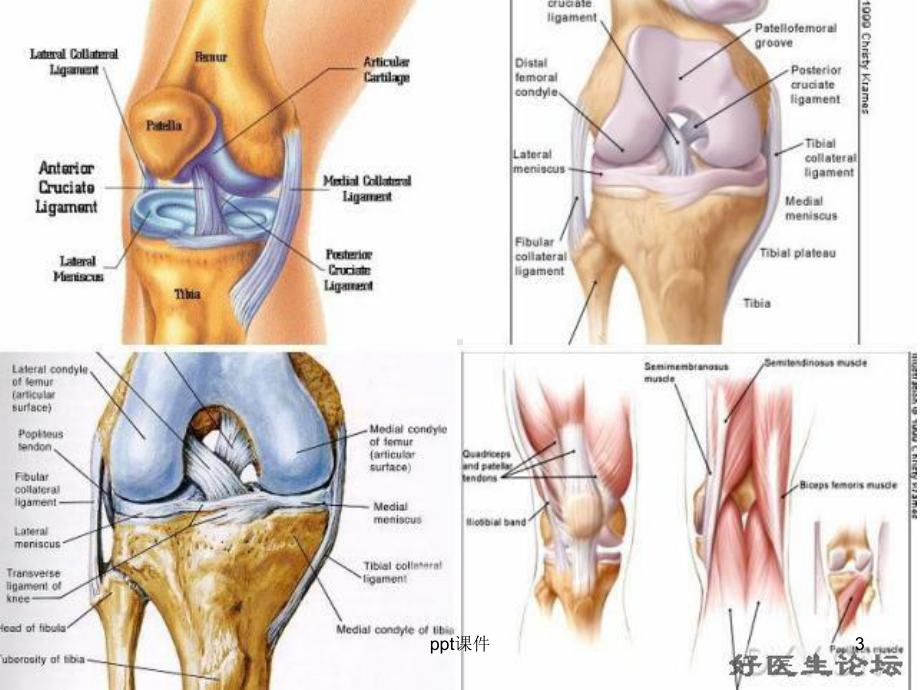 膝关节的肌动学-ppt课件.ppt_第3页