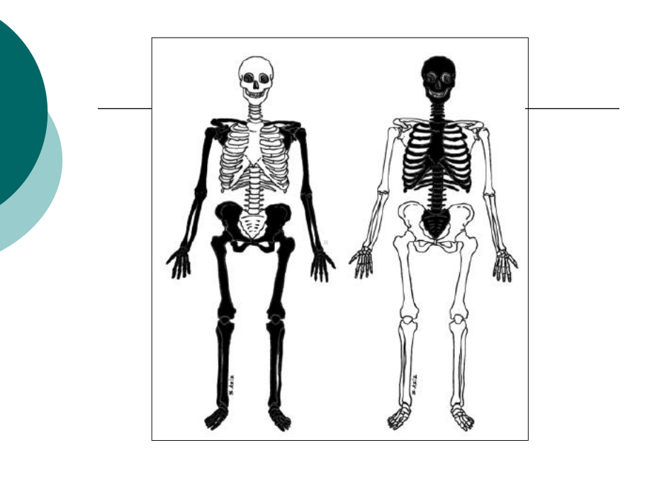 骨显像PPT课件(同名1342).ppt_第2页