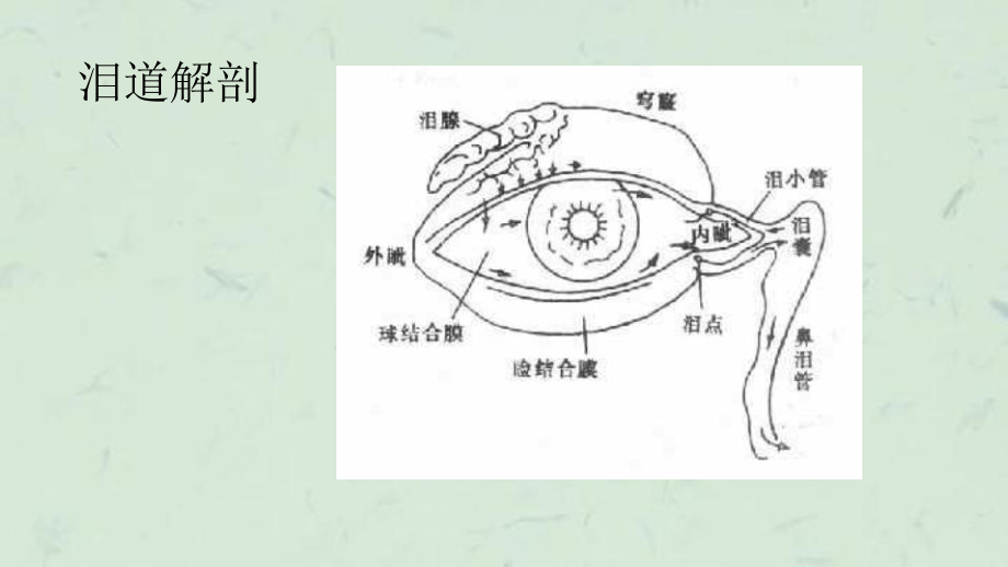 泪道冲洗修课件.ppt_第3页