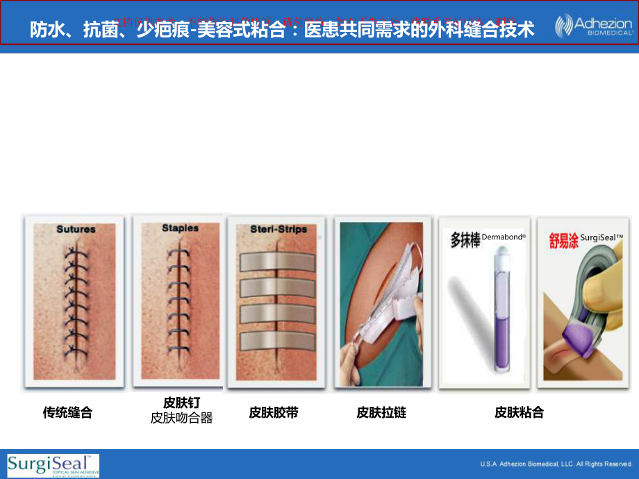 医用粘合剂产品介绍课件.ppt_第1页