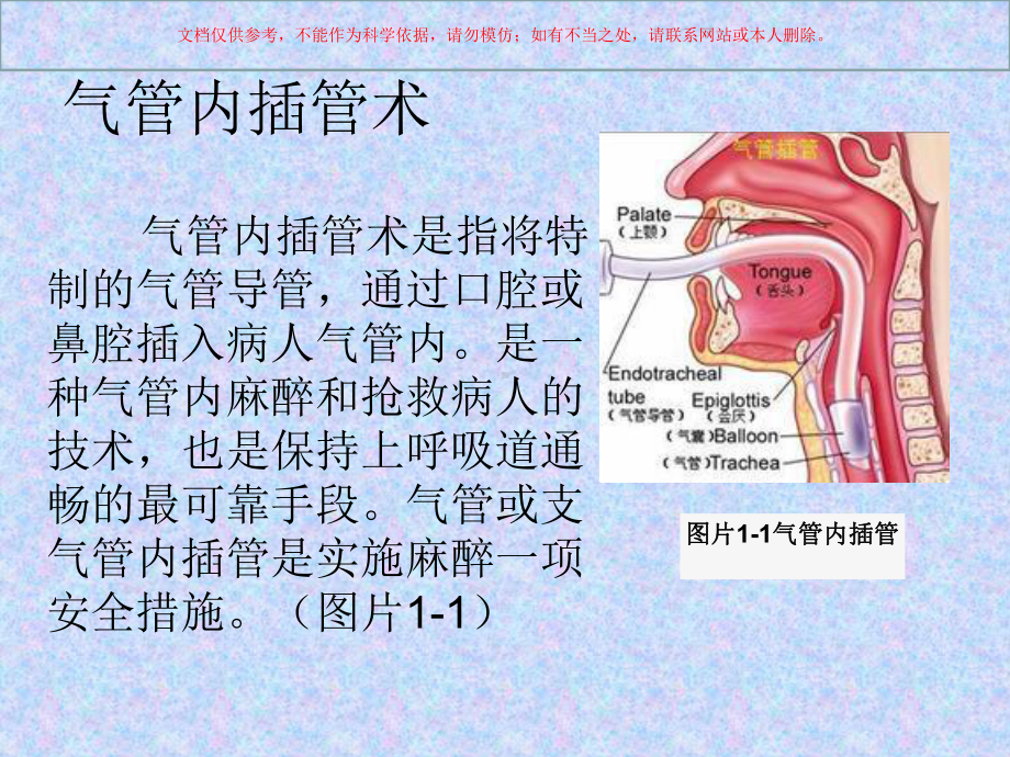 气管插管术培训培训课件.ppt_第1页