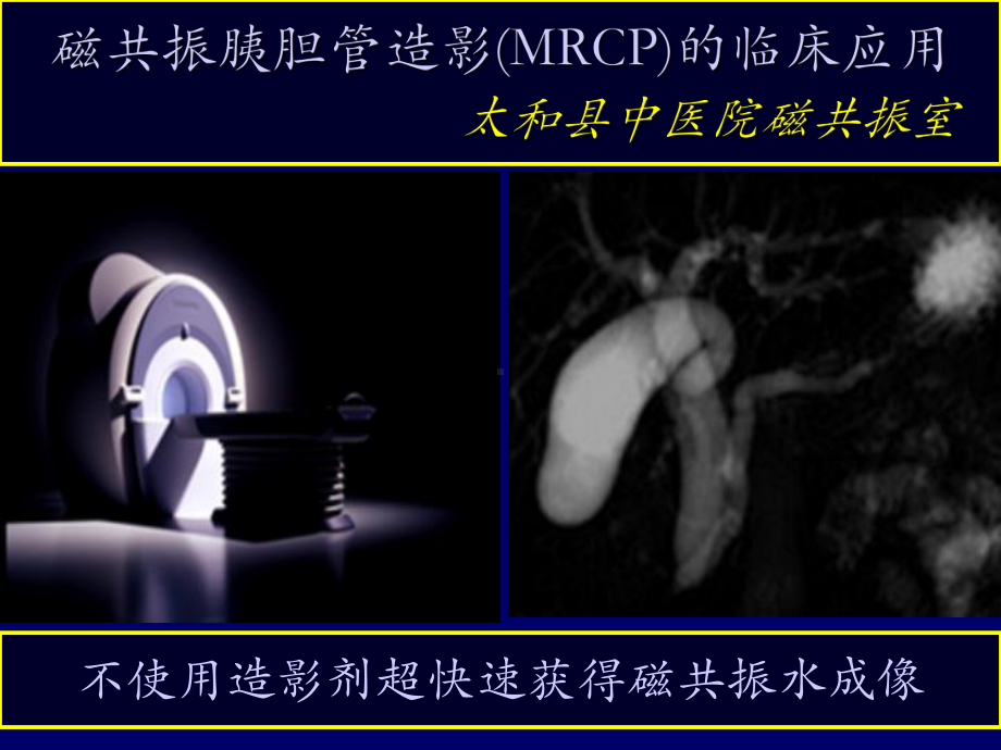 MRCP.ppt省年会课件.ppt_第1页