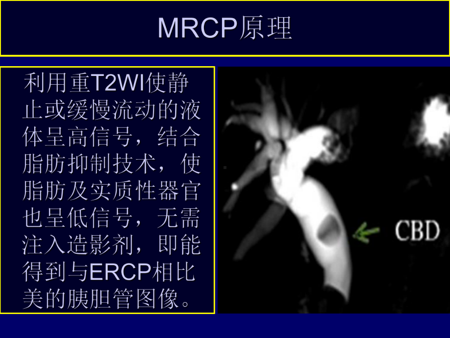 MRCP.ppt省年会课件.ppt_第2页