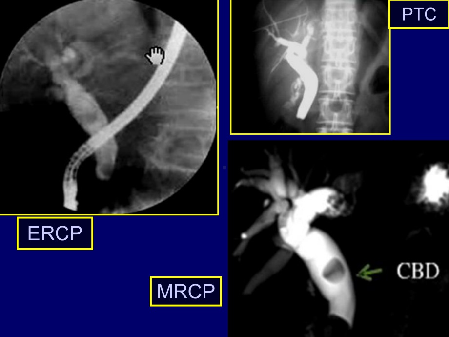 MRCP.ppt省年会课件.ppt_第3页