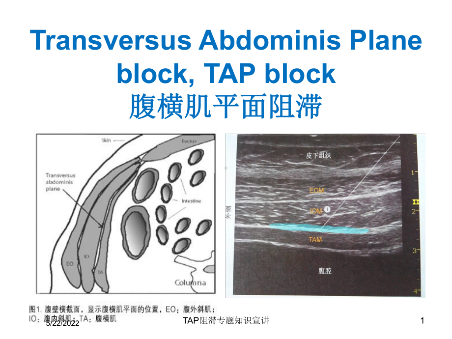 TAP阻滞专题知识宣讲培训课件.ppt_第1页