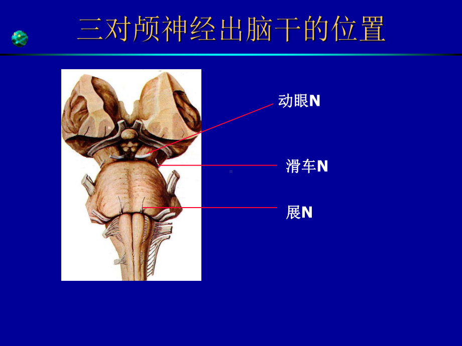 最新眼肌麻痹专题讲座主题讲座课件.ppt_第2页