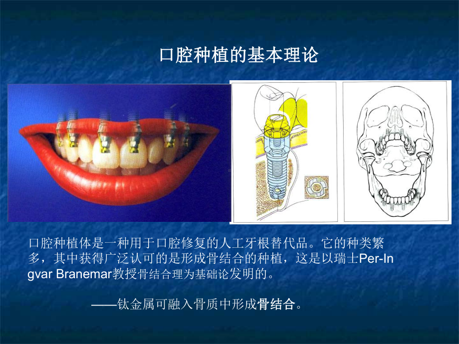 关于种植系统ppt课件.ppt_第2页