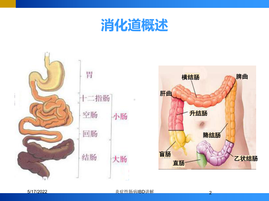 炎症性肠病IBD讲解培训课件.ppt_第2页