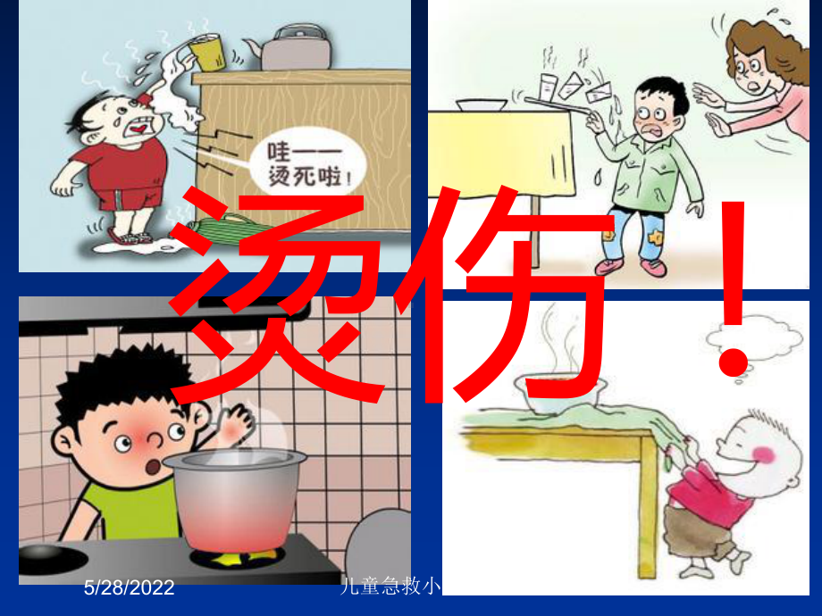 儿童急救小常识培训课件.ppt_第2页