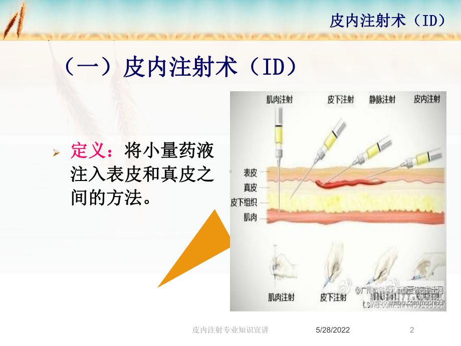 皮内注射专业知识宣讲培训课件.ppt_第2页