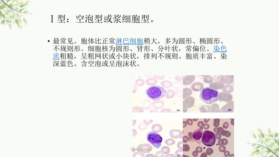 异常淋巴细胞形态课件(同名1574).ppt_第3页