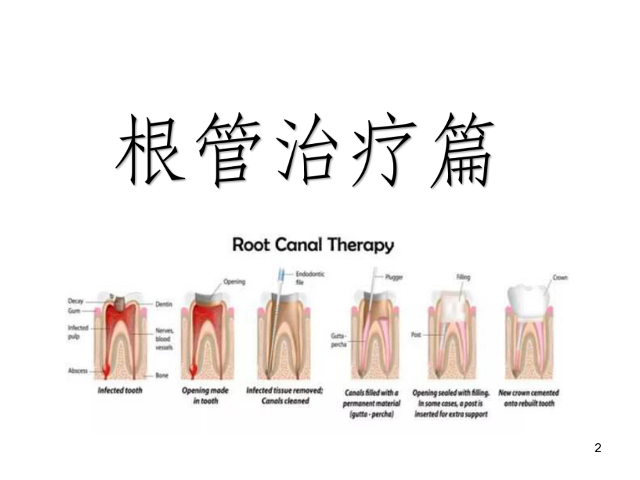 口腔器械认知PPT课件.ppt_第2页