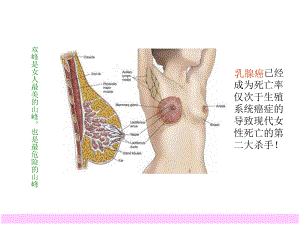 关爱乳房-PPT课件.ppt