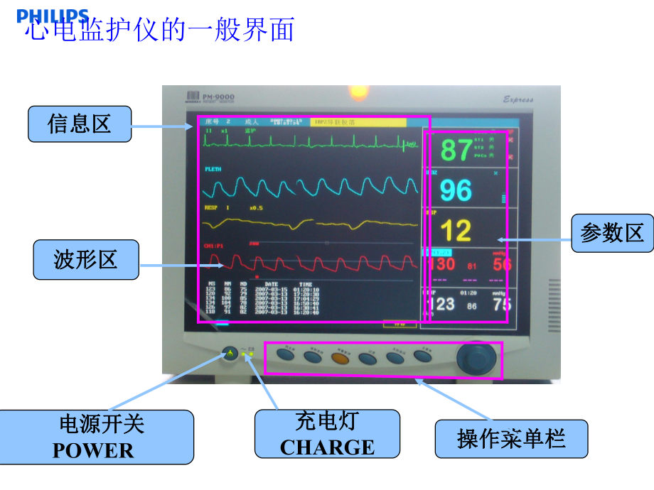 飞利浦监护仪-PPT课件.ppt_第2页