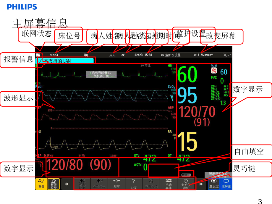 飞利浦监护仪-PPT课件.ppt_第3页