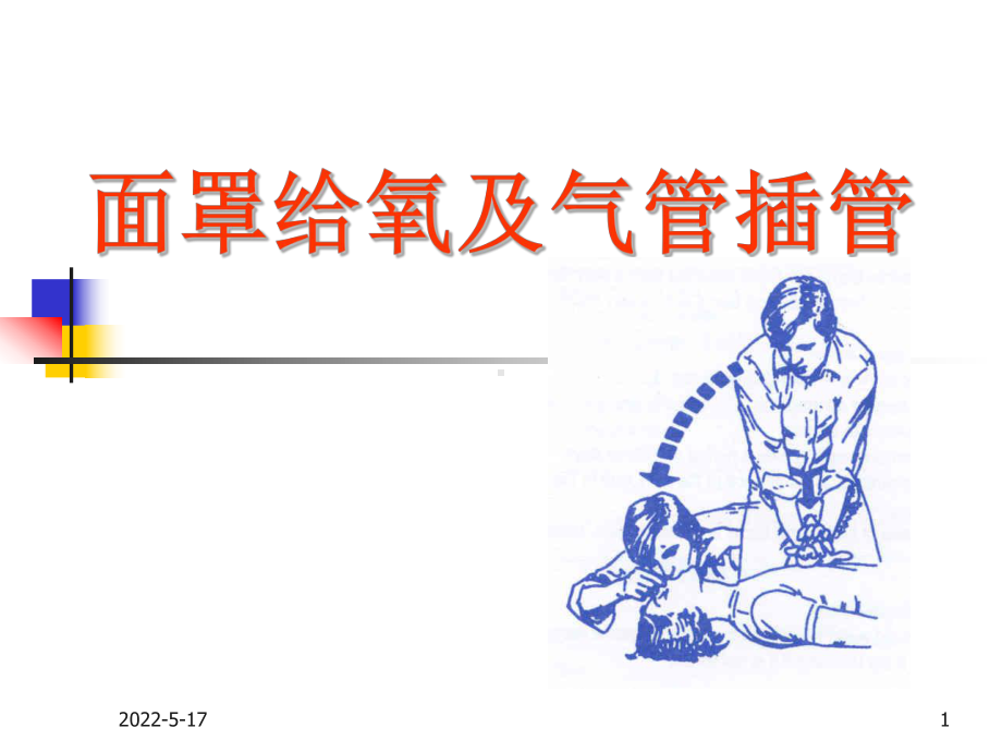 气管插管课件.ppt_第1页