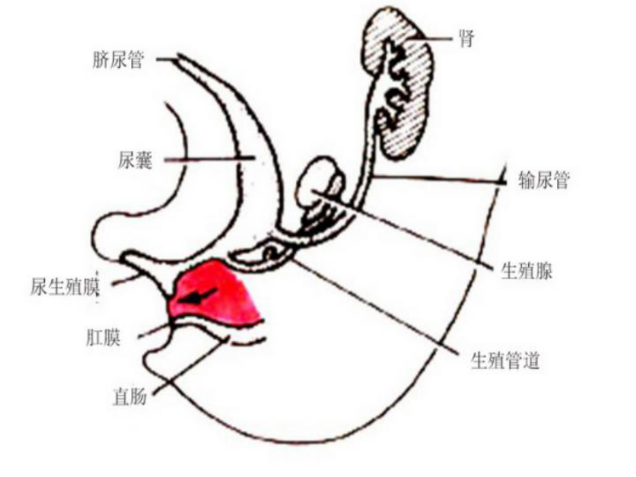 脐尿管囊肿PPT课件.ppt_第3页