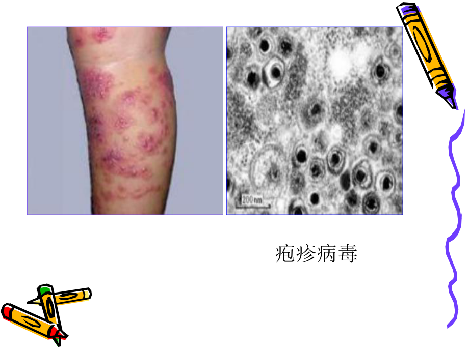 微生物的危害-PPT课件.ppt_第3页