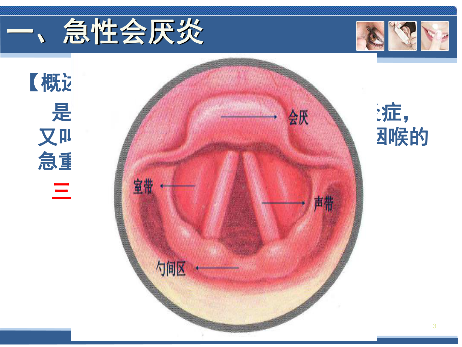 常见疾病喉部疾病PPT课件.ppt_第3页