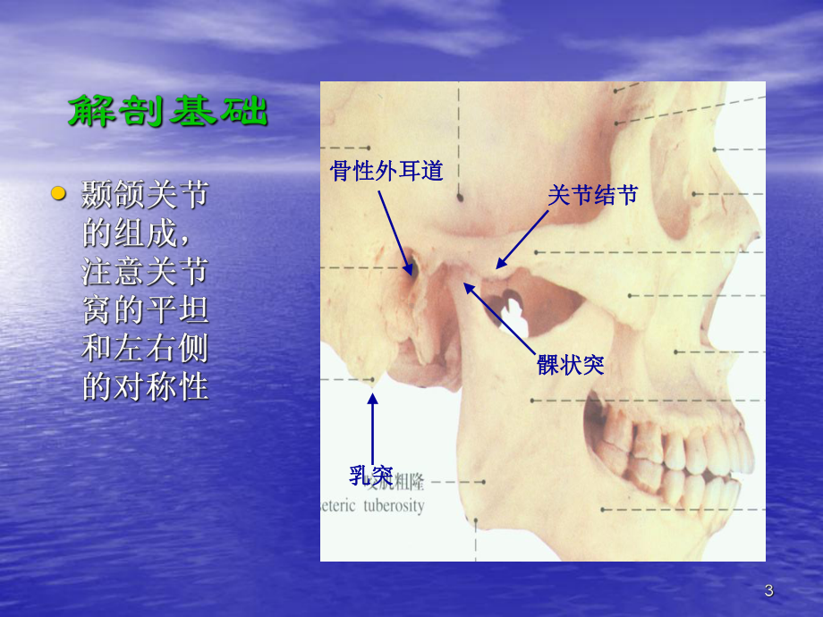 颞颌关节脱位PPT课件.ppt_第3页