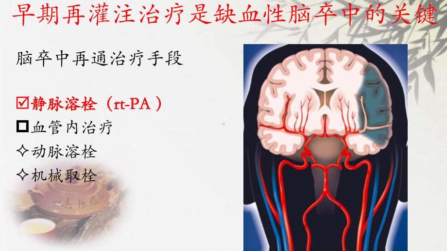 静脉溶栓后出血性转化的培训课件.ppt_第3页