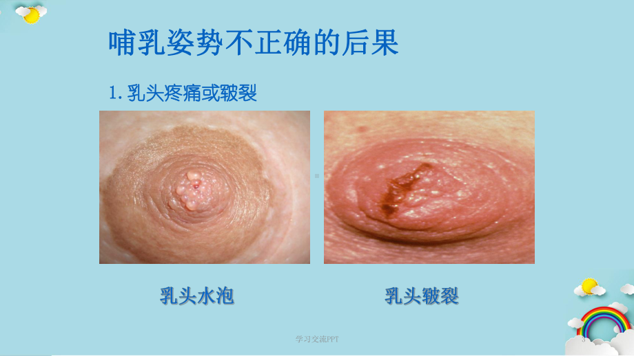 正确的哺乳姿势课件.ppt_第3页