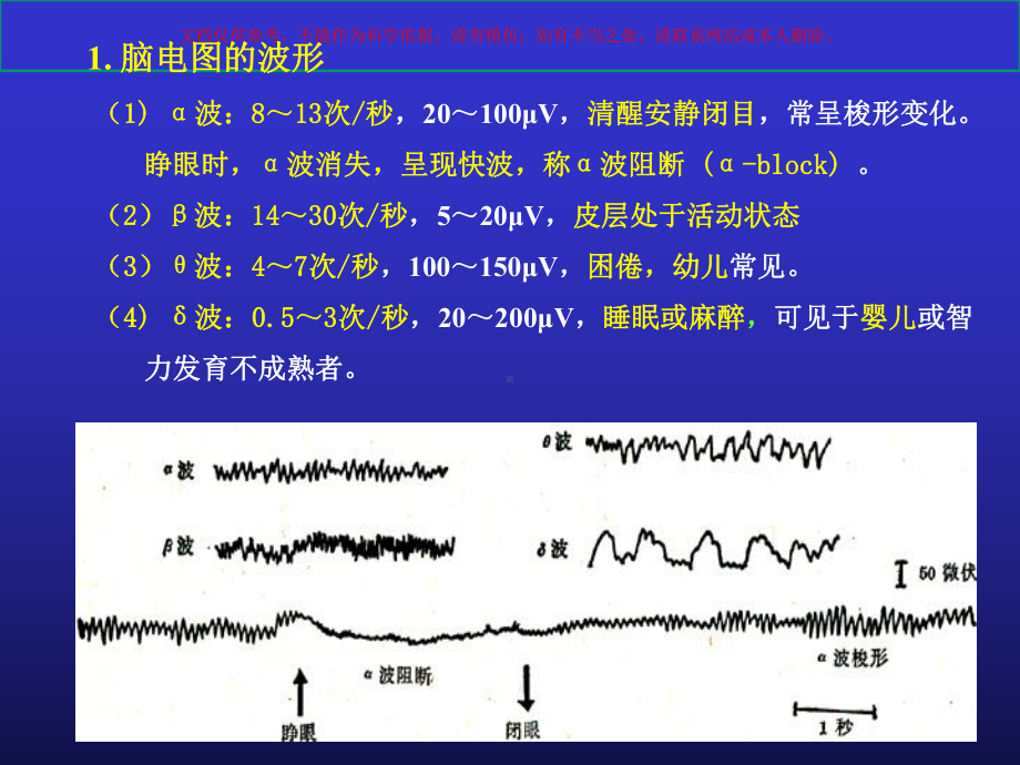 睡眠机制和睡眠障碍课件.ppt_第2页