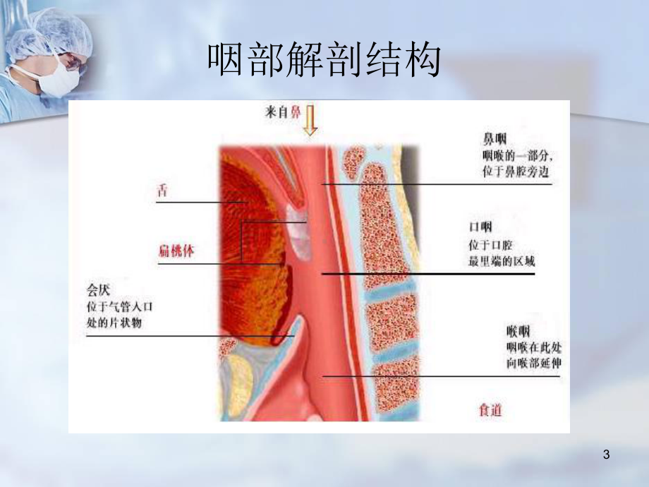 喉罩ppt课件.ppt_第3页