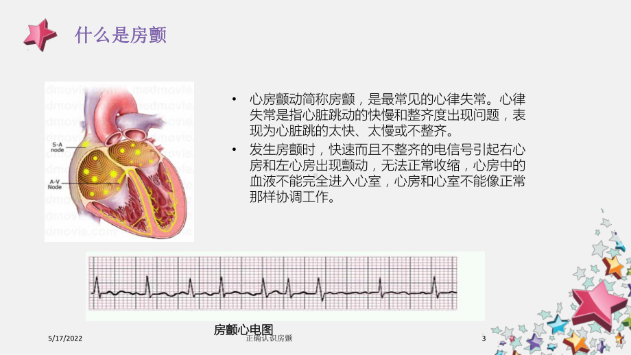 正确认识房颤培训课件.ppt_第3页