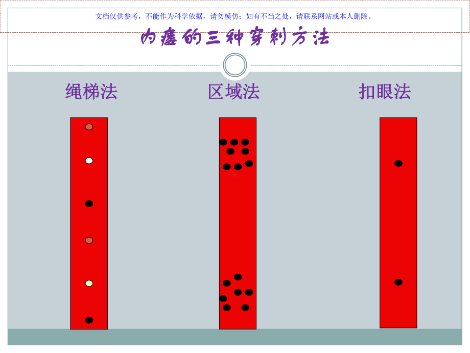 血透患者内瘘扣眼穿刺课件.ppt_第3页