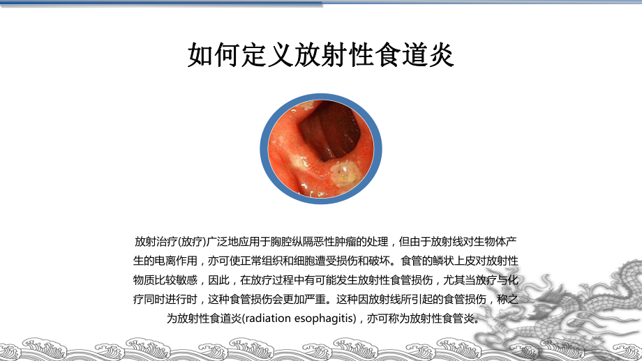 放射性食道炎PPT培训课件.ppt_第3页