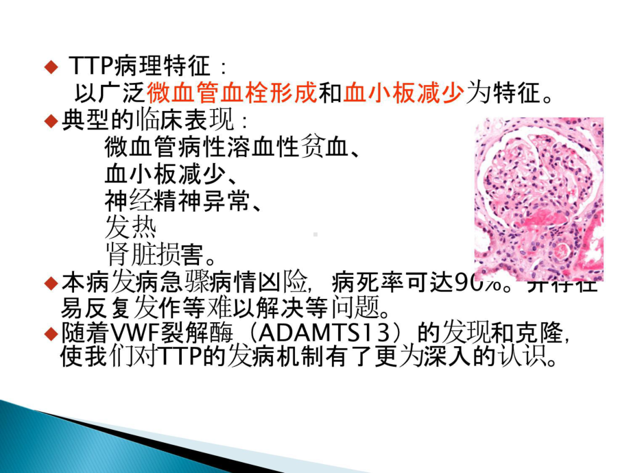 TTP诊治住院医师规培-PPT课件.ppt_第2页