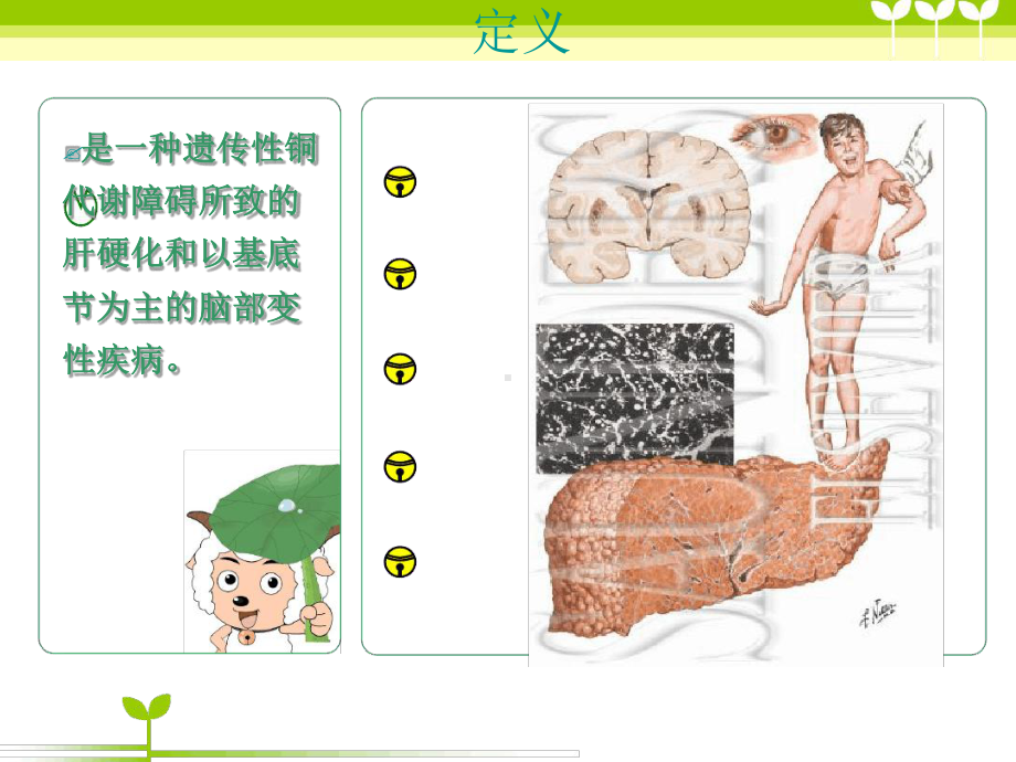 肝豆状核变性教案课件.ppt_第3页