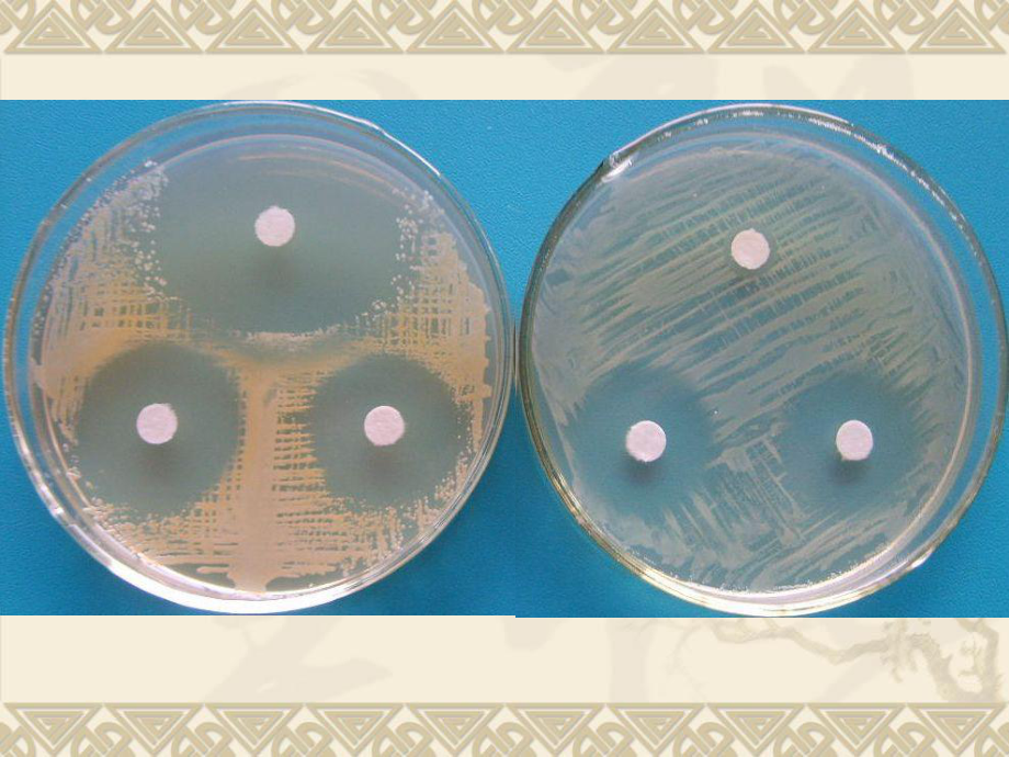 微生物实验6-PPT课件.ppt_第2页