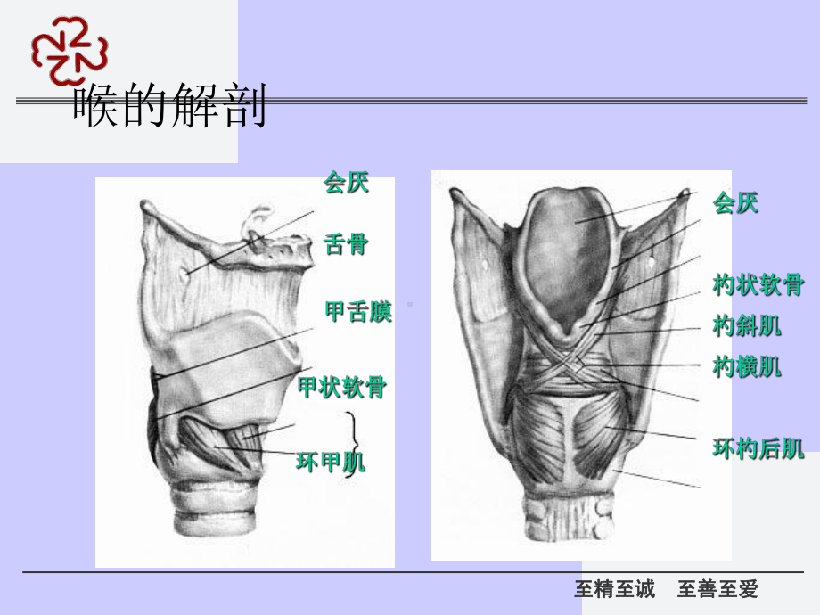 喉部疾病及气管切开课件.ppt_第3页