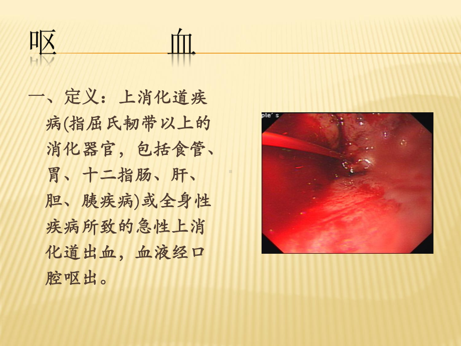 呕血与便血教学课件.ppt_第3页